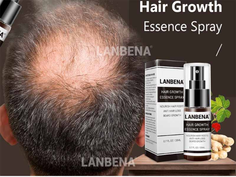 فروش ویژه اسپری و محلول ضد ریزش مو و تقویت کننده مو lanbena