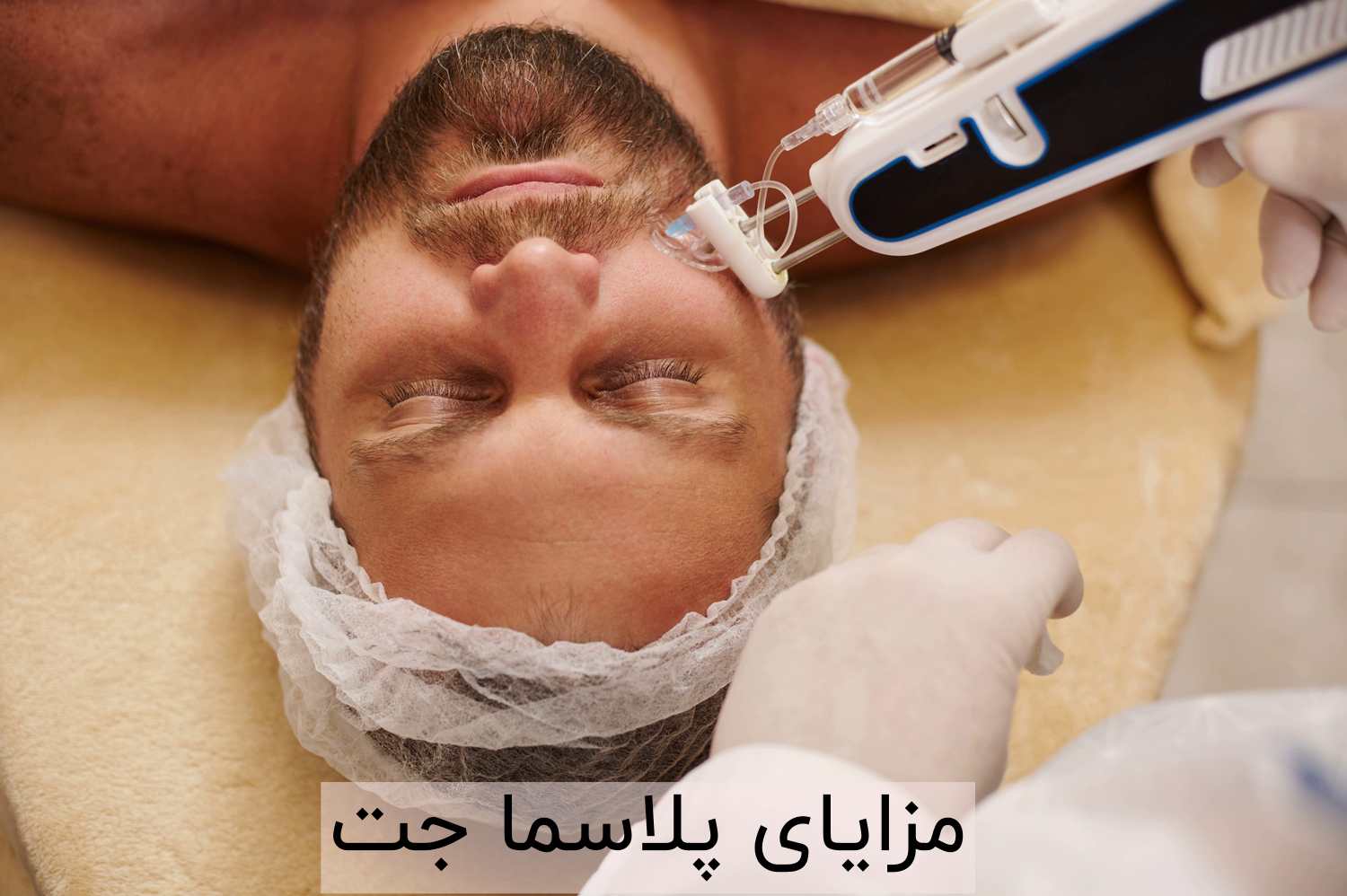 مزایا پلاسما جت
