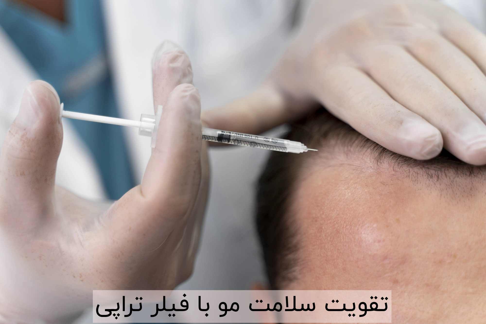 تقویت سلامت مو با فیلر تراپی