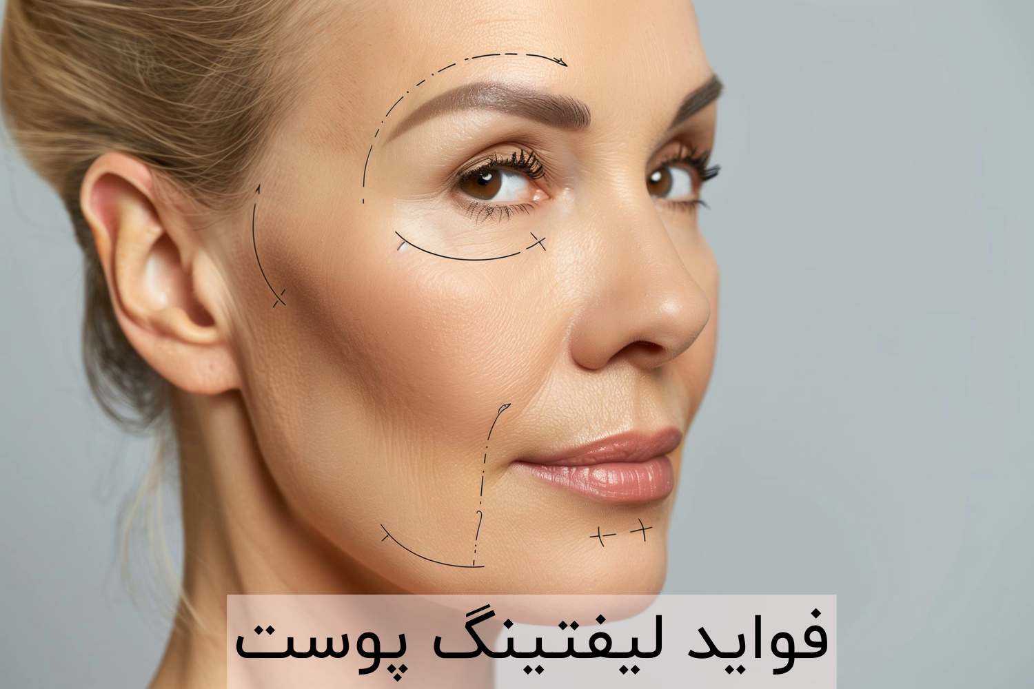 فواید لیفتینگ پوست صورت