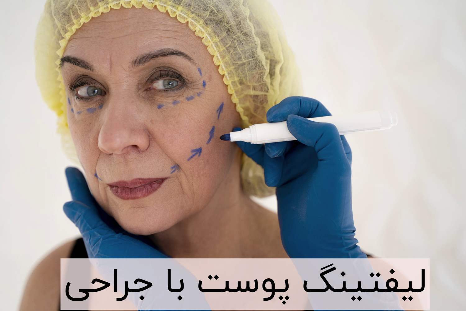 لیفتینگ پوست با جراحی